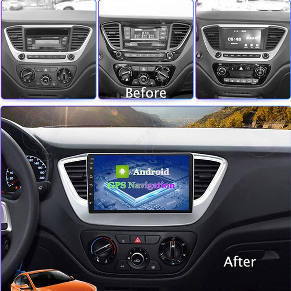 Consola Hyundai Verna / Accent 9" Pulgadas 2017 (NEGRO)